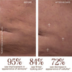 NUBODY Starter Kit | Smooth & Tone Full Body Microcurrent Device