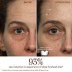 TRINITY+ Microcurrent Facial Trainer Attachment - Facial Sculpting Attachment