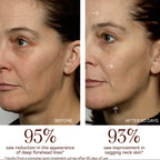 MINI+ Starter Kit - Petite Pro-Longevity Microcurrent Facial Sculpting Device