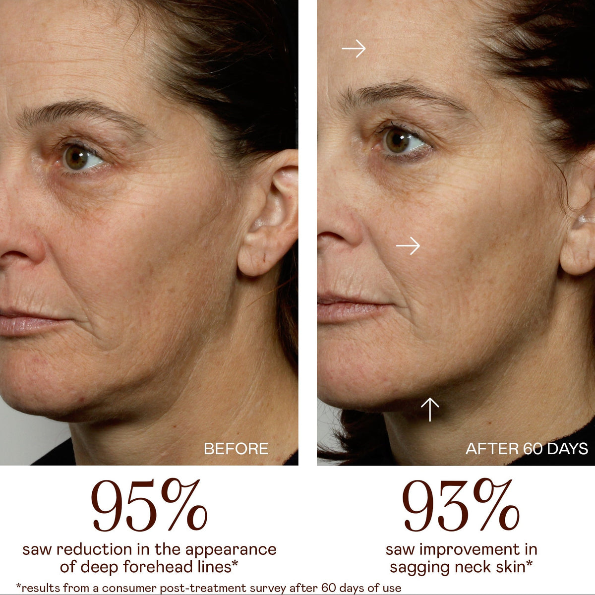MINI+ Starter Kit - Petite Pro-Longevity Microcurrent Facial Sculpting Device